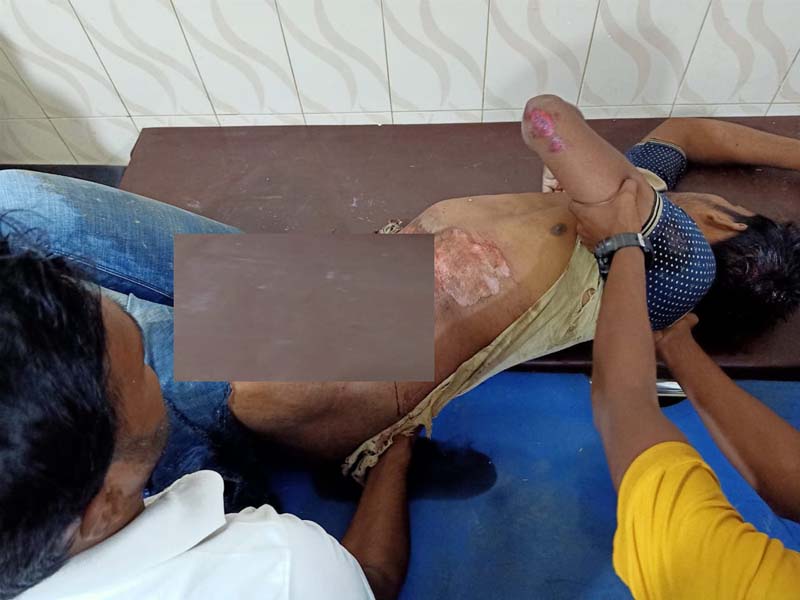 খাগড়াছড়িতে বাসের ধাক্কায় মোটরসাইকেল চালক নিহত