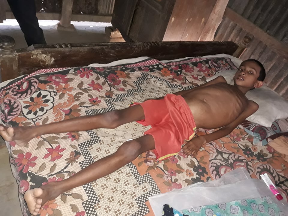 দীঘিনালায় বিরল রোগে আক্রান্ত ১০ বছরের শিশু আরিফ!