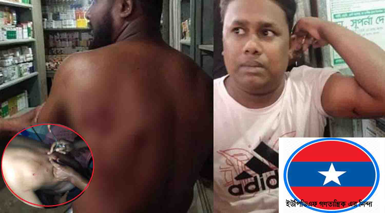 সাজেকে দুই ব্যবসায়ীর উপর গুলিঃইউপিডিএফ গণতান্ত্রিক’র নিন্দা  