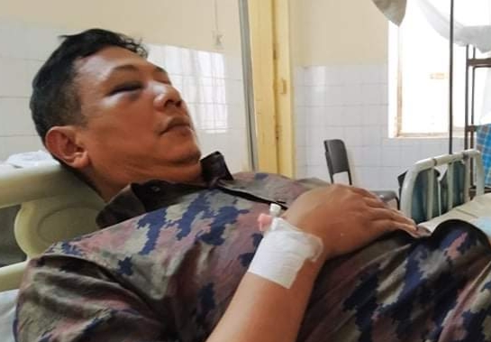 চোখে মারাত্বক আঘাত পেলেন রুমা পাইন্দু ইউপি চেয়ারম্যানঃহয়নি মামলা