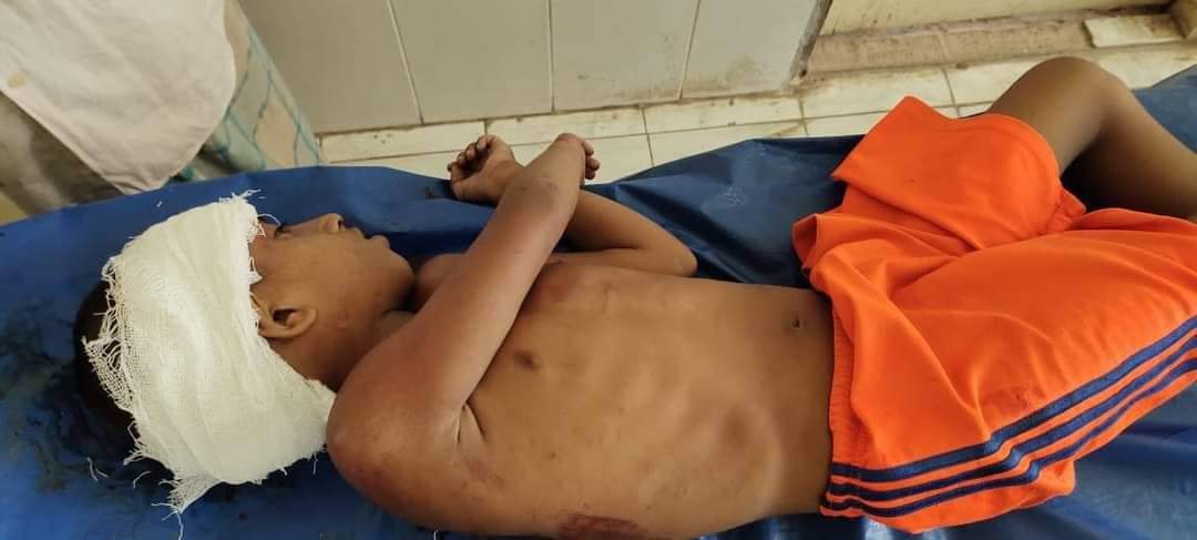 বান্দরবানে ইজিবাইকের ধাক্কায় ৯ বছরের শিশু নিহত