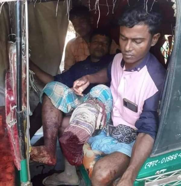 নাইক্ষ্যংছড়ির ফুলতলী সীমান্তে মাইন বিস্ফোরণে  এক যুবকের পায়ের পাতা বিচ্ছিন্ন