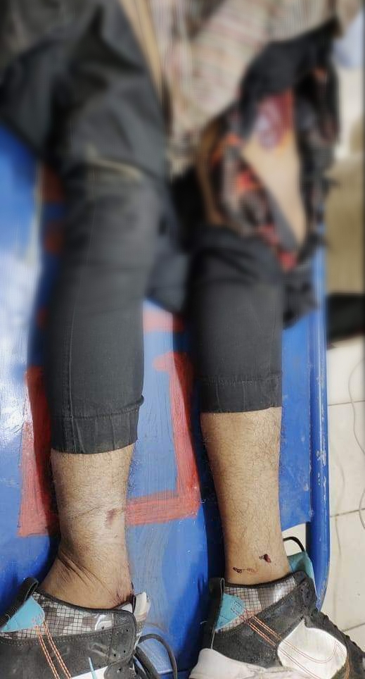 বান্দরবানে কাঠ বোঝাই ট্রাকের ধাক্কায় পর্যটক মৃত্যু 