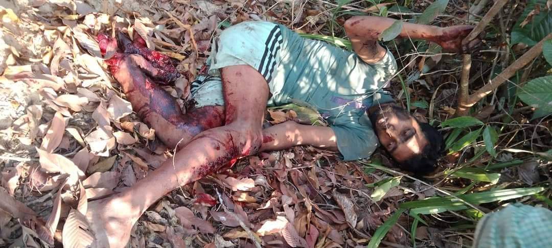 নাইক্ষ্যংছড়ির সীমান্তে মাইন বিস্ফোরণে  উড়ে গেছে যুবকের বাম পা