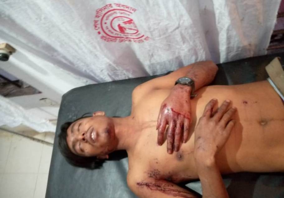 থানচিতে ফেরার পথে সন্ত্রাসীদের গুলিতে  আহত ২