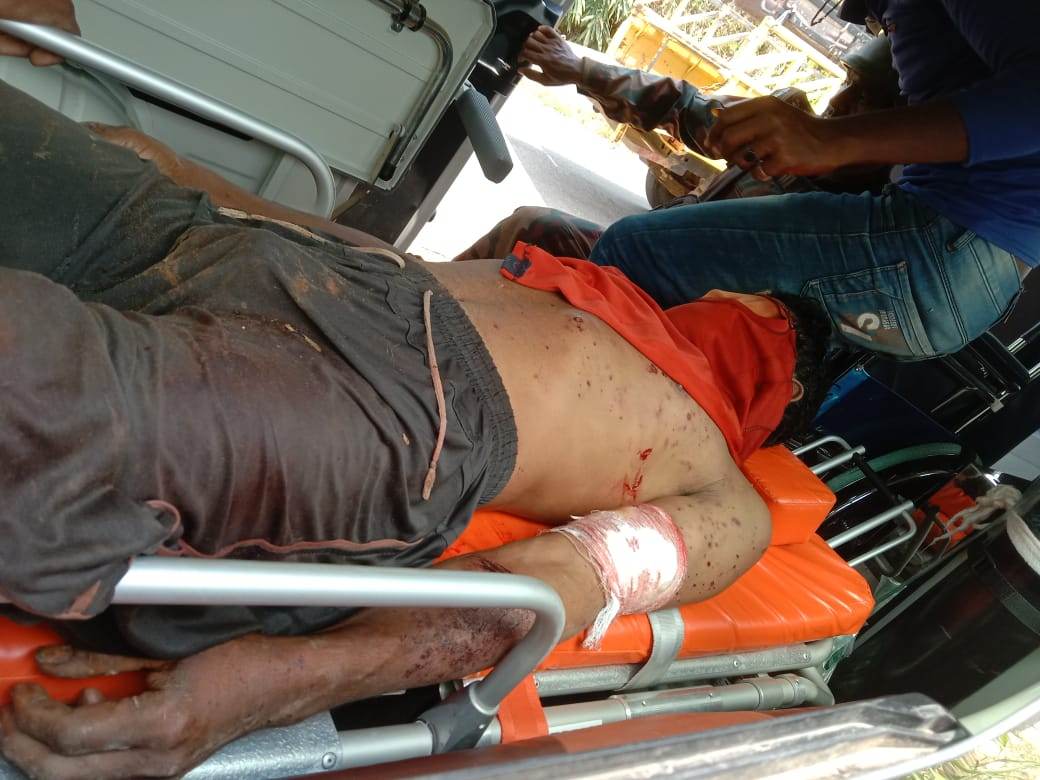 বান্দরবানে কেএনএফ'র পুতে রাখা মাইন বিস্ফোরনে হতাহত-২