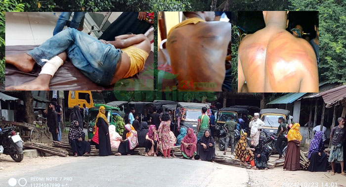 রাজস্থলীতে মগপার্টির হামলায় গুরুত্বর আহত-২; প্রতিবাদে সড়ক অবরোধ