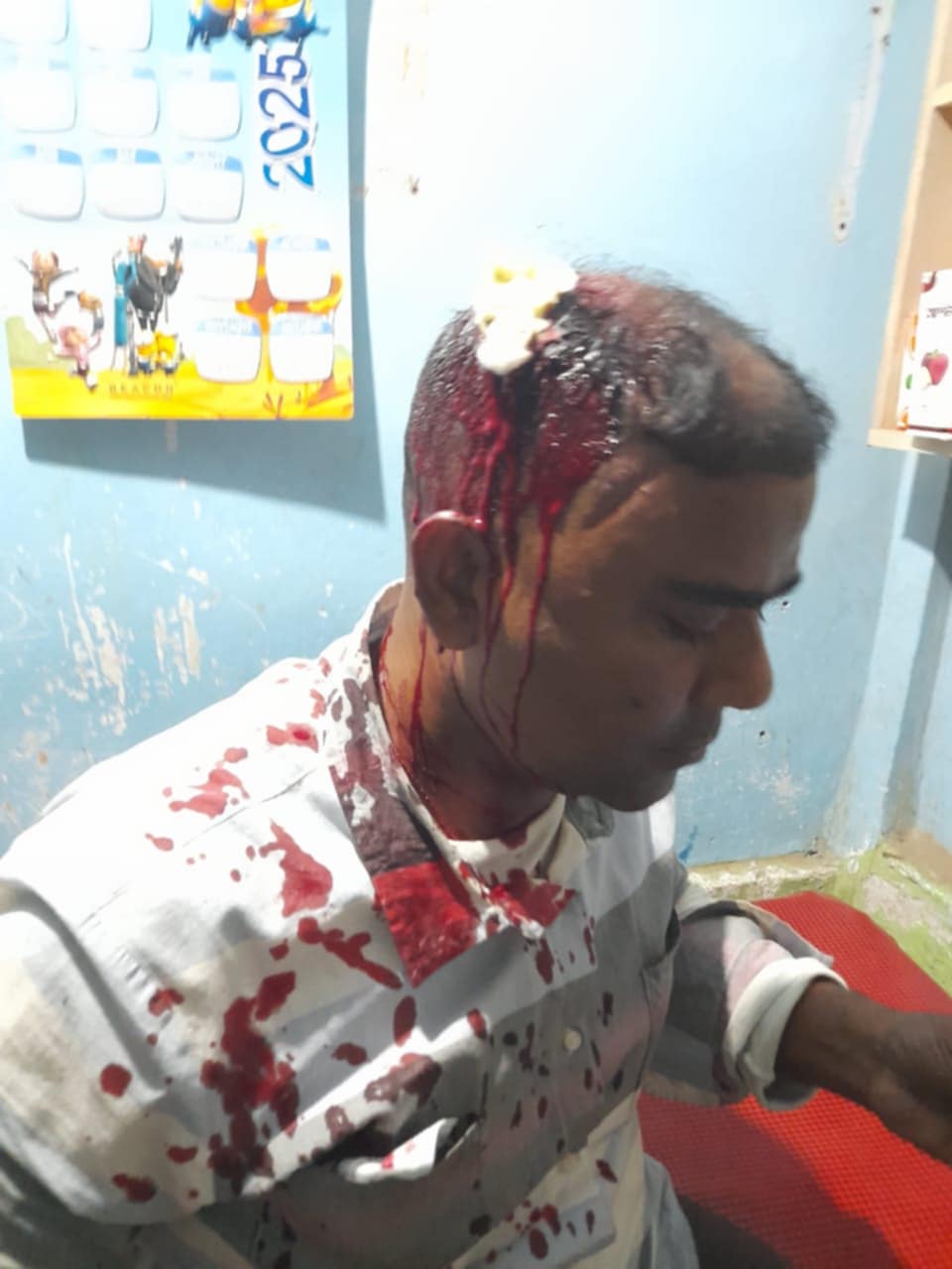 কাপ্তাইয়ে টিসিবি ডিলারকে মেরে রক্তাক্ত