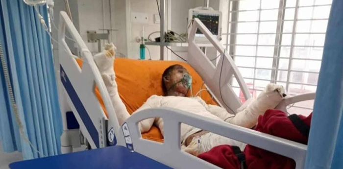 মাইলস্টোনে বিমান দুর্ঘটনায় রাজস্থলীর উক্যচিং মারমার অবস্থা আশঙ্কাজনক