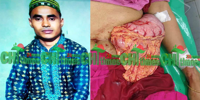 রাঙামাটিতে ছুরিকাঘাতে স্ত্রীর ভূড়ি বের করে দিলো মাদকাসক্ত স্বামী