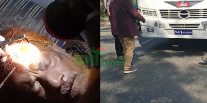 বিএন ০৬-১৫৩ নম্বর স্কুল বাসের ধাক্কায় গুরুতর আহত এক ব্যক্তি