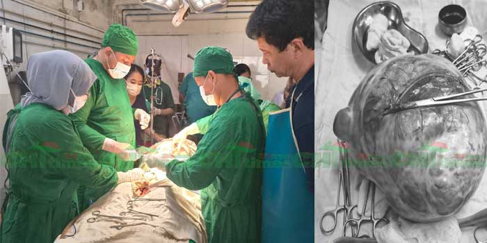 রাঙ্গামাটি জে. হাসপাতালে বিরল সাফল্য: বৃদ্ধার শরীর থেকে ১০ কেজি ওজনের টিউমার অপসারণ