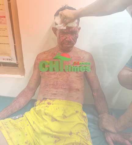 রাঙামাটিতে মধ্যরাতে বিদ্যালয়ের প্রহরীকে হত্যাচেষ্টার অভিযোগ
